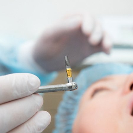 A dentist holding a dental implant while performing implant surgery