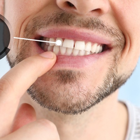 A man pointing out his implanted tooth 