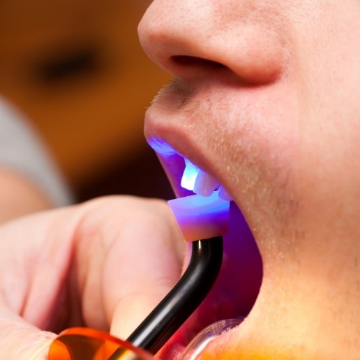 Dentist shining light into a patient's mouth
