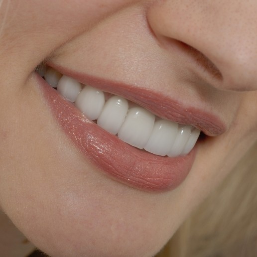Close up of blonde woman with even gums smiling