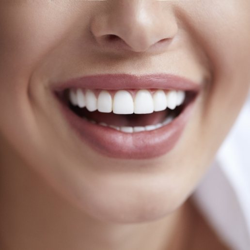 Close up of woman with straight white teeth grinning