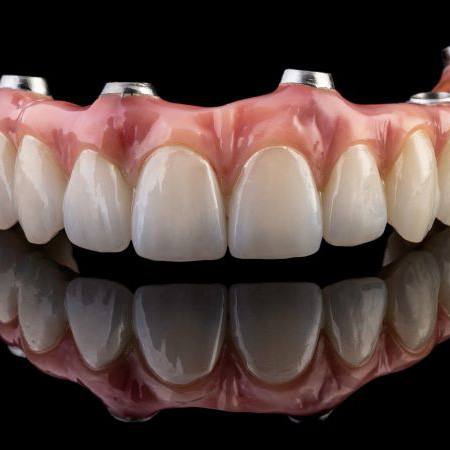 Implant denture sitting on reflective surface