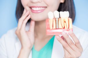 woman holding model of dental implant while touching her chin and smiling
